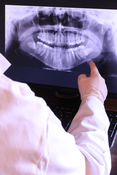 Best Emergency Dentist for Lost Fillings or Crowns in Coral Hills, MD
