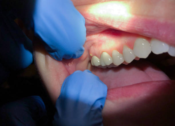 Best Emergency Dental Services for Seniors in Coral Hills, MD