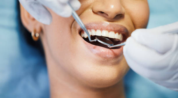 Best Emergency Dental Care for Abscessed Tooth in Coral Hills, MD